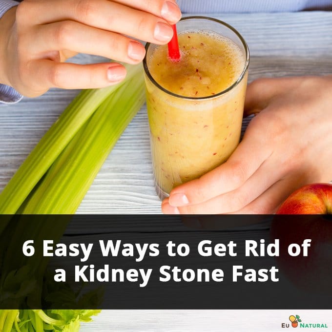 6-easy-ways-to-get-rid-of-a-kidney-stone-fast