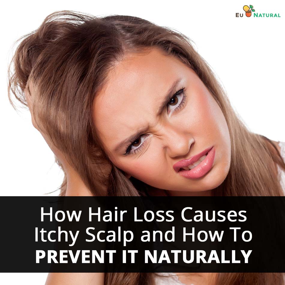 How Hair Loss Causes Itchy Scalp And How To Prevent It Naturally 950x950 